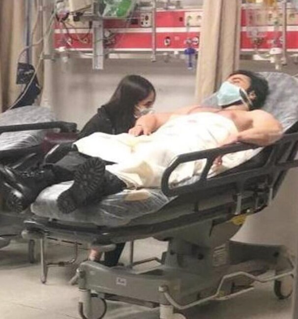 Məşhur aktyorun alın sümüyü qırıldı - FOTOLAR