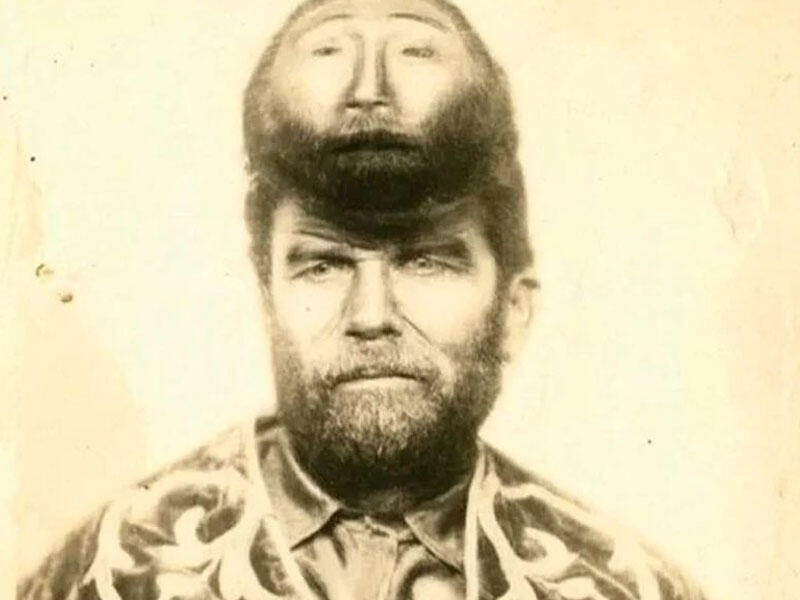 İkibaşlı adamın maraqlı həyatı - Alnındakı əlavə üzü ilə qürur duyurdu