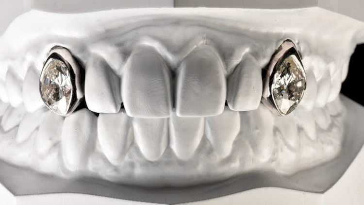 Tanınmış reper dişlərinə 2 milyonluq brilyant qoydurdu - FOTO