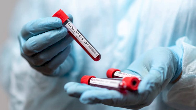 Ermənistanda 96 yeni yoluxma – COVID-19