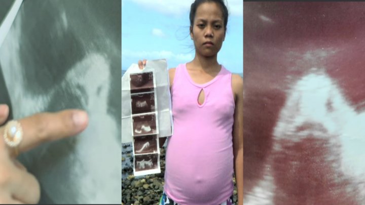 17 yaşlı qız balıqdan hamilə qaldı? - DƏHŞƏTLİ VİDEO