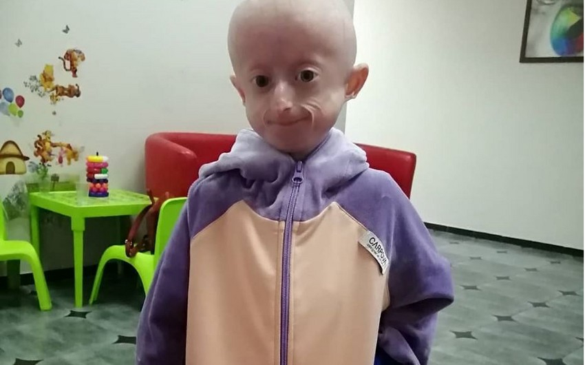 10 yaşlı qız qocalıqdan öldü - VİDEO