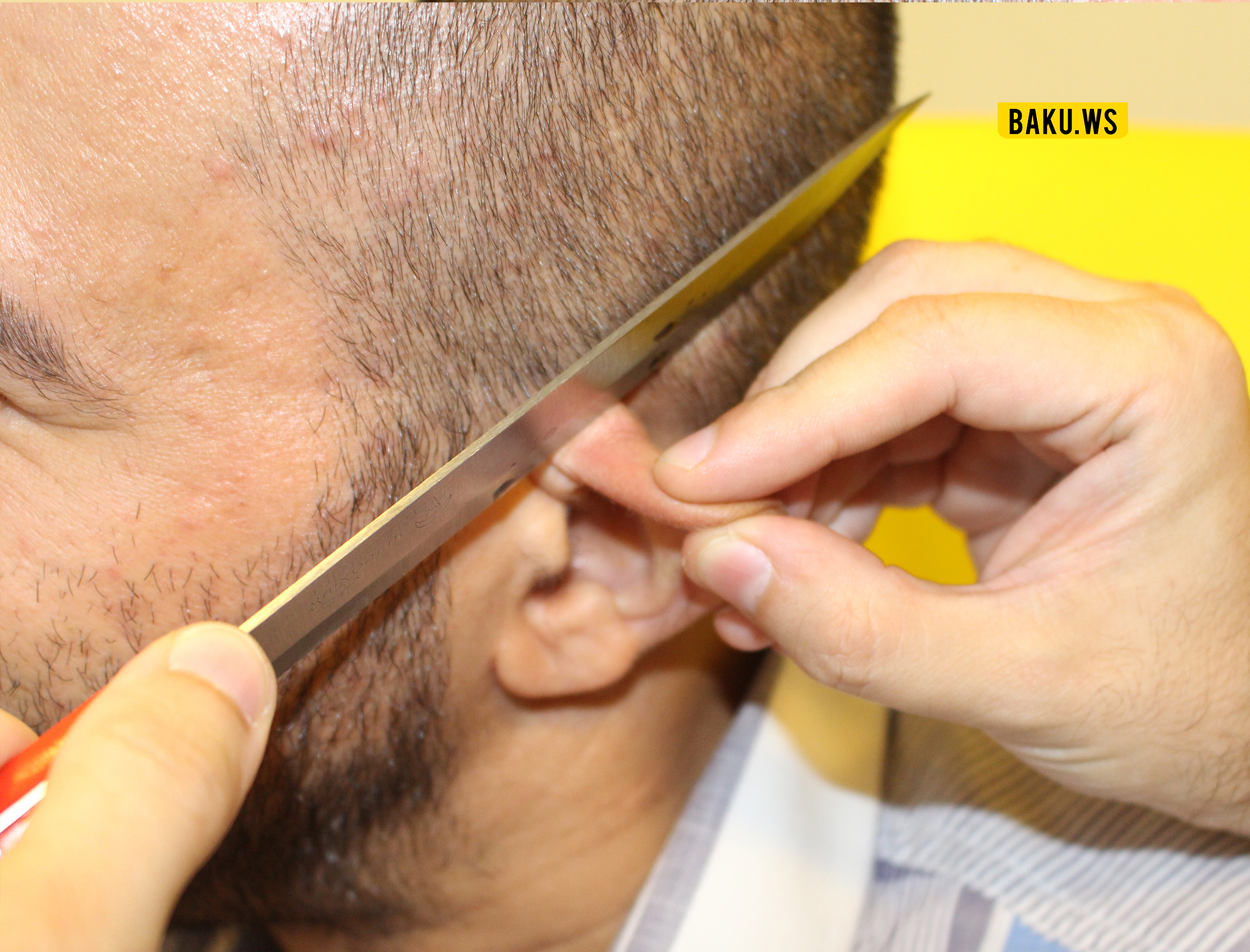 Azərbaycanda 37 yaşlı kişinin qulağını kəsdilər