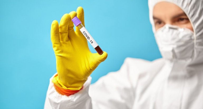 Rusiyada bir gündə 734 nəfər koronavirusdan ölüb