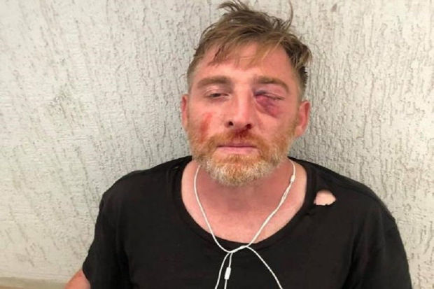 Gürcüstanda aksiya zamanı hücuma məruz qalan media nümayəndəsi vəfat edib