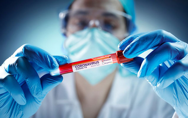 Türkiyədə yoluxanların sayı artdı