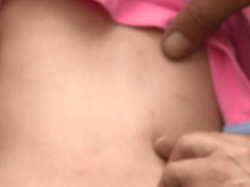 Bakıda bağçada uşağa qarşı zorakılıq - 2 yaşlı uşağı bu hala kim saldı? - VİDEO