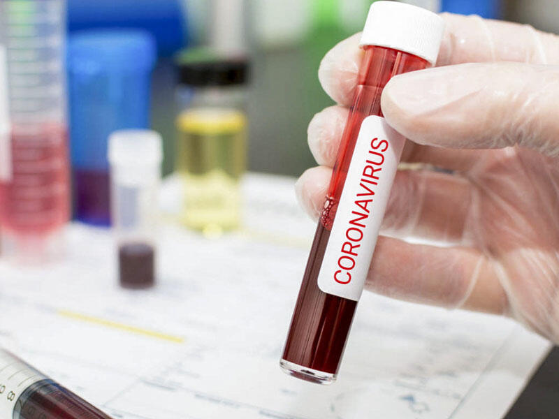 Peyvənd əks göstəriş olan şəxslərin NƏZƏRİNƏ