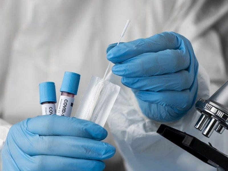 Qazaxıstanda koronavirusa daha 5 179 nəfər yoluxdu