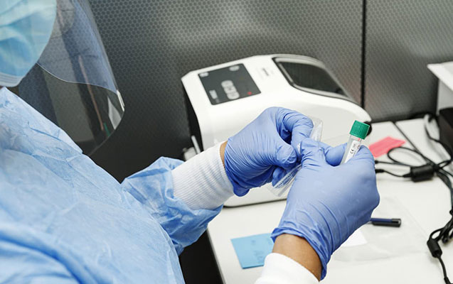 Azərbaycanda son sutkada koronavirusa 386 yeni yoluxma faktı qeydə alınıb - FOTO