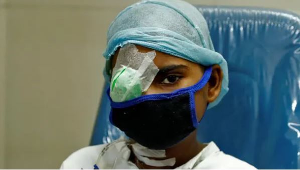 Koronavirusdan sağalanların kabusu: Bu xəstəliyə tutulanların yarısı ölür