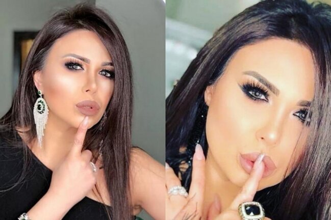 Pişik Günel kökəlib BU HALA DÜŞDÜ - FOTO/VİDEO