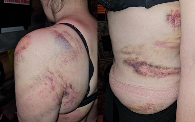 Arvadını bıçaqlayaraq öldürən şəxs barədə RƏSMİ AÇIQLAMA