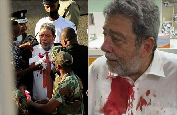 Karib ölkəsinin baş nazirini vaksinə qarşı etiraz aksiyasında yaraladılar - FOTO/VİDEO