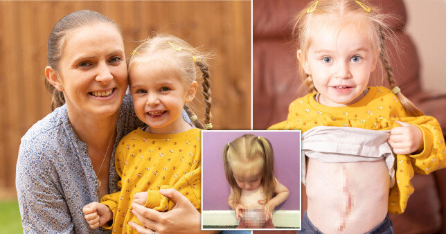 Bu qızın bağırsaqları anadangəlmə bayırdadır - FOTOLAR