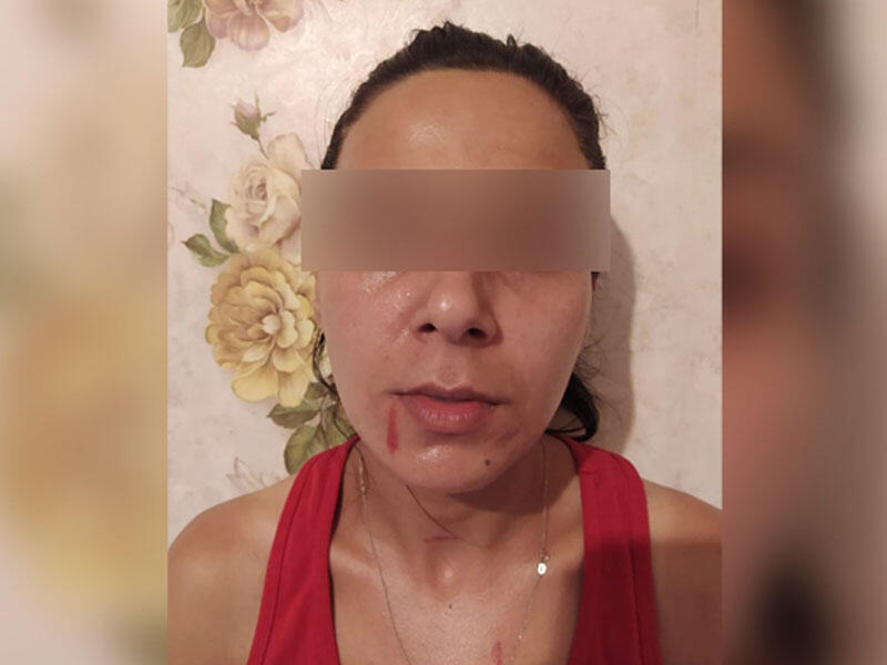 Döyülmüş fotosu yayılan qadının əri saxlanıldı