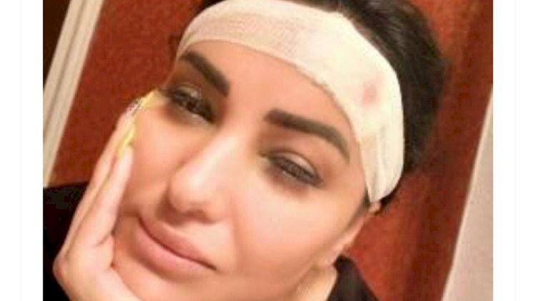 Vüsalənin başına iş gəldi: Alnına tikiş qoyuldu