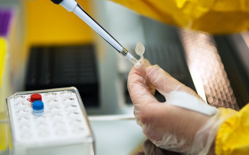 Ermənistanda daha 383 nəfər COVID-19-a yoluxub