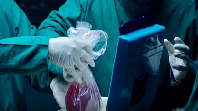 Sabiq icra başçısının adı orqan alverində - Bir böyrək 30 min manata