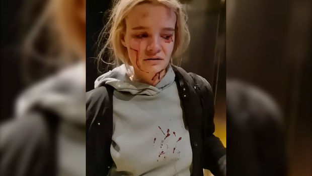 Liftdə qalan qadın ölümdən son anda döndü - VİDEO