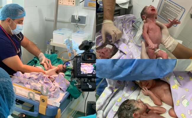 Bakıda dördəm doğulub