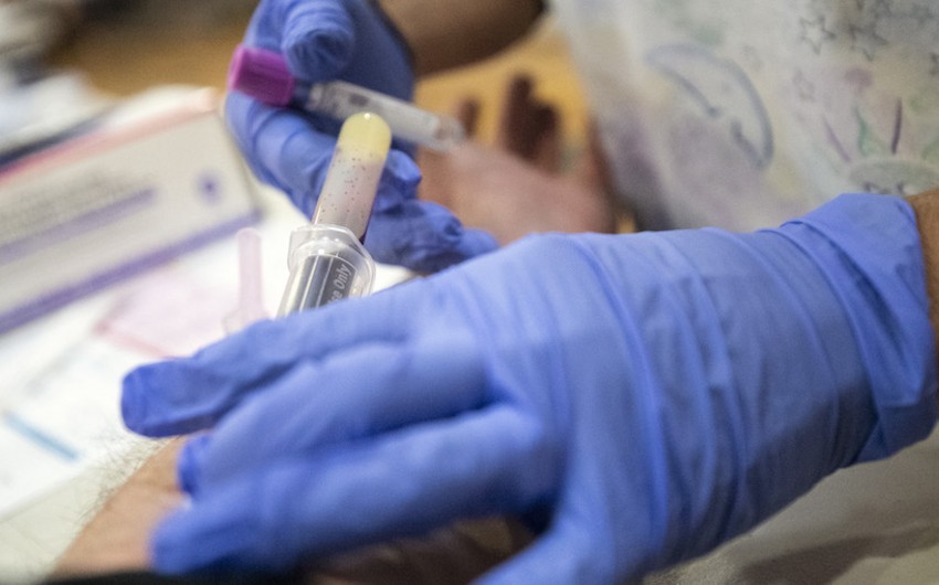 Dünyada koronavirusa yoluxma sayında azalma müşahidə olunur