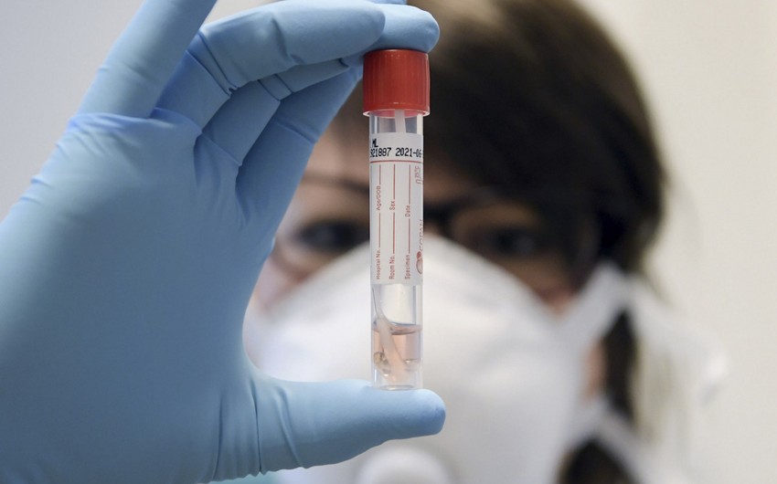 Gürcüstanda son sutkada COVID-19-dan 52 nəfər ölüb