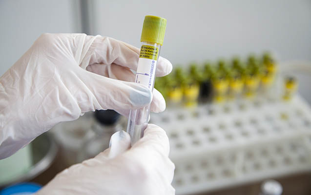 Rusiyada koronavirusun yeni ştamı aşkar olundu