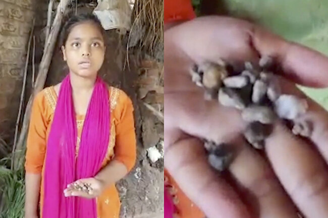 Qızın gözündən yaş əvəzinə daş gəlir - VİDEO