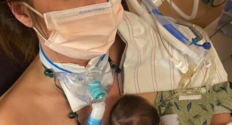 COVID-ə yoluxan hamilə qadın komada ikən uşaq doğdu – Kuryoz