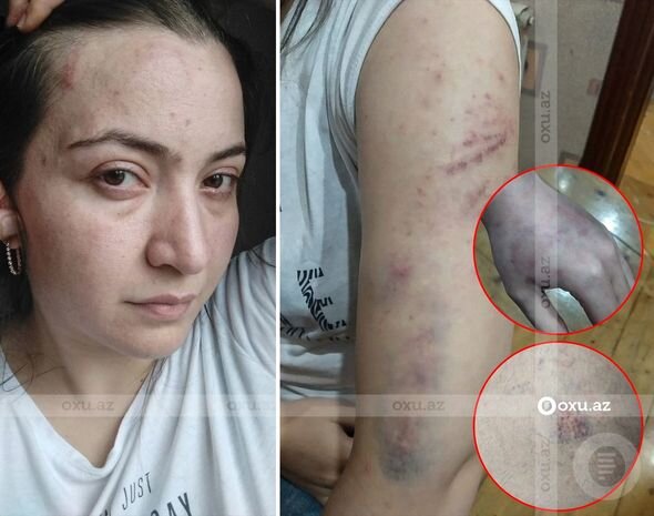 Polis əri tərəfindən şöbədə qətlə yetirilən qadının qardaşı gizlinləri açdı - FOTOLAR