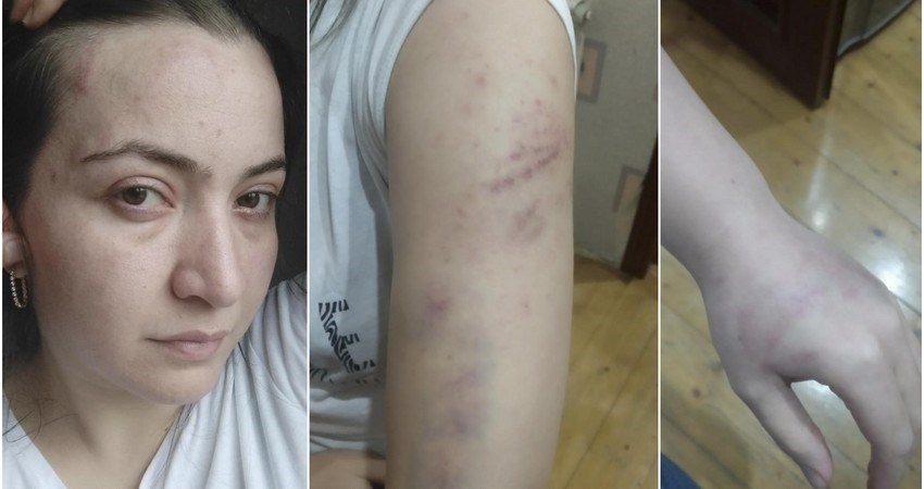 Polis əri tərəfindən güllələnərək öldürülən qadının övladlarının kimin qəyyumluğuna veriləcəyi məlum olub