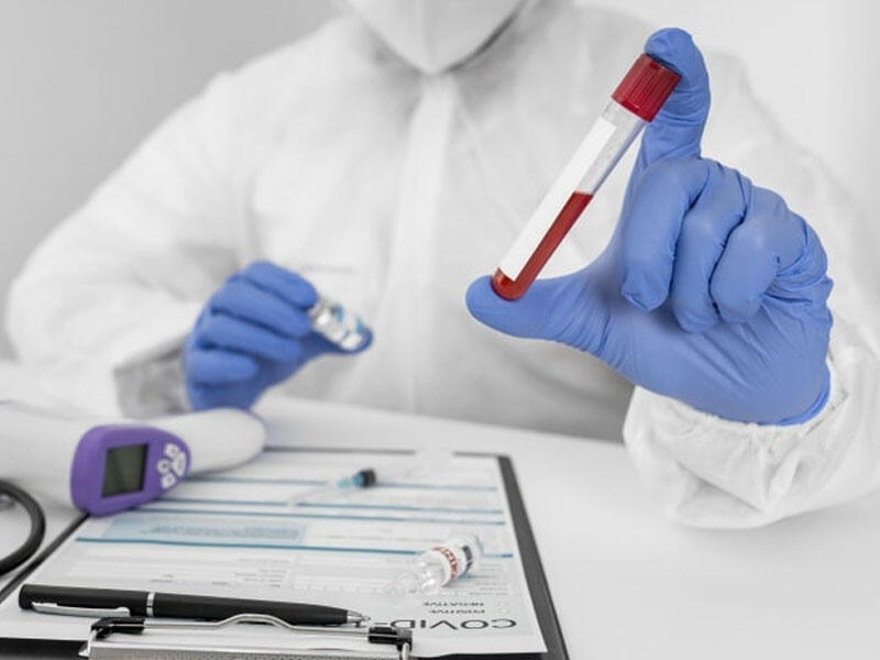 Ölkə üzrə COVID-19-a yoluxma statistikası açıqlandı