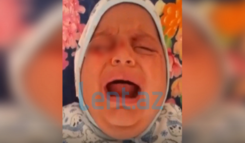 Azərbaycanda gözlərindən qan gələn uşaqla bağlı YENİ XƏBƏR - 