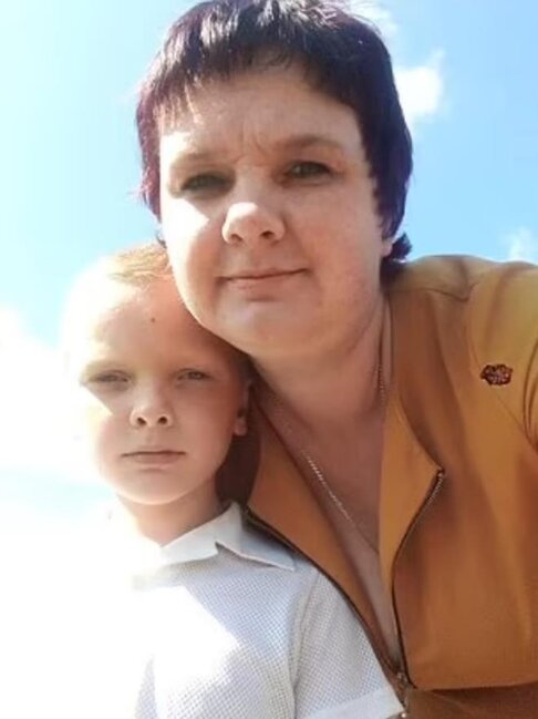 Ərinə xəyanət edən qadın oğlunu yandırdı: Hər şeyi atasına dediyi üçün - FOTOLAR