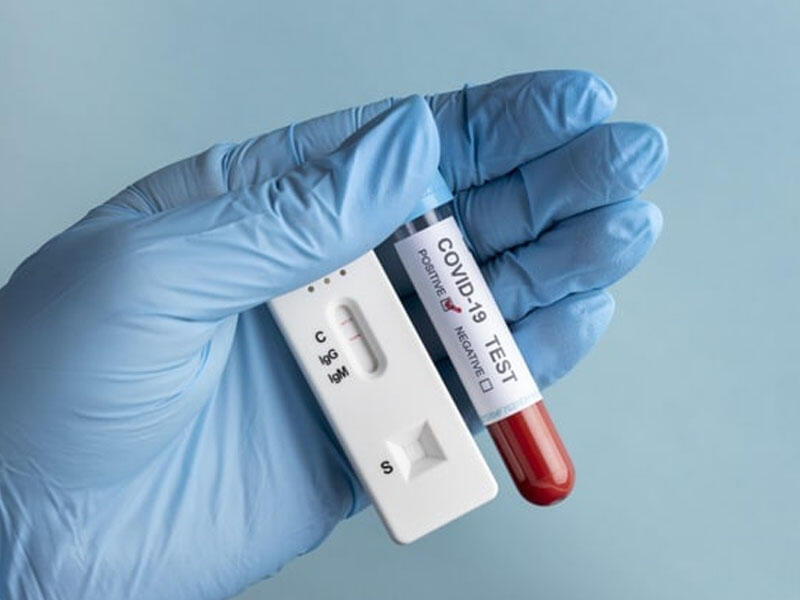 Rusiyada COVID-19-a yoluxma və ölüm halında növbəti rekord qeydə alınıb