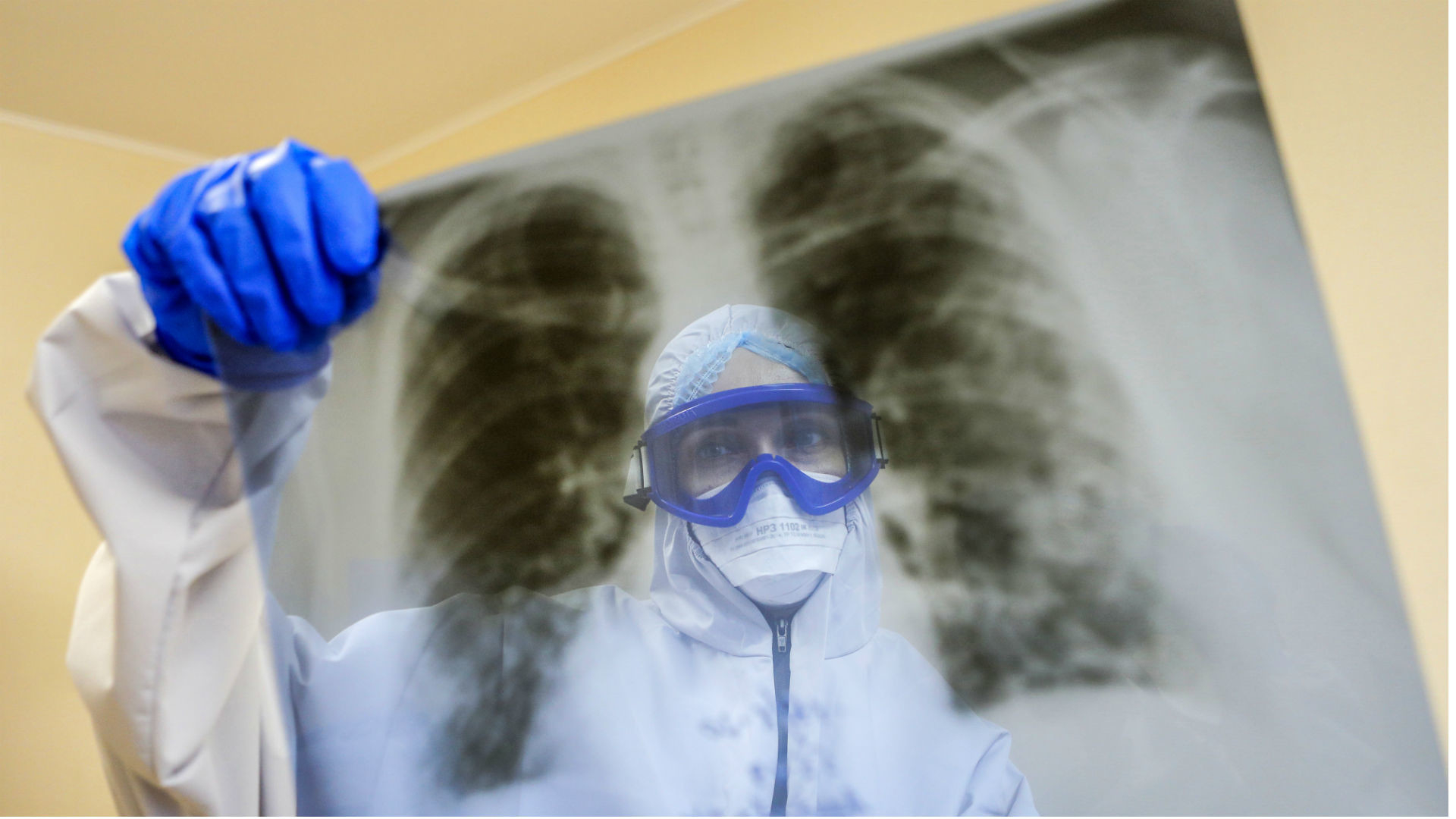 Koronavirusun daha çox zədələdiyi orqanlar AÇIQLANDI