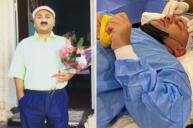 Известный азербайджанский актер перенес операцию - ФОТО