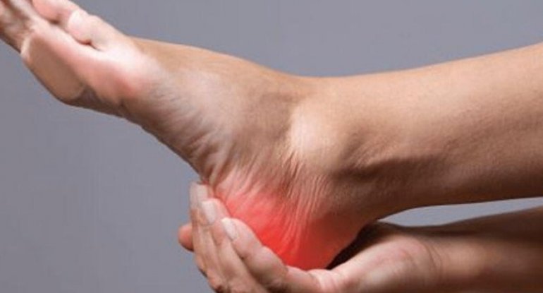 Ayaqların altında yanma hissi - Səbəbləri araşdıraq