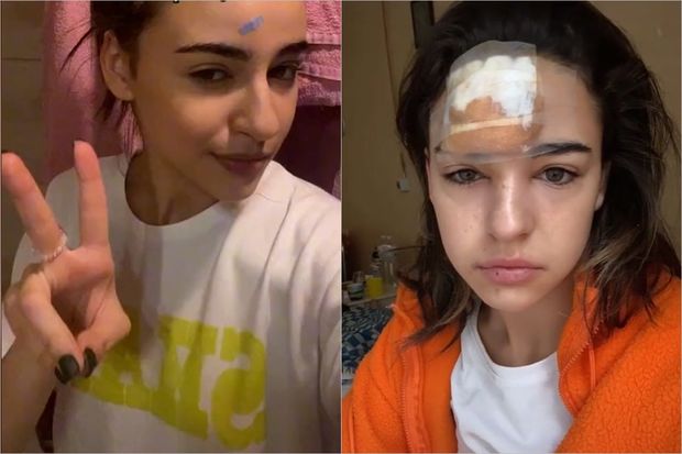 Alnındakı sızanağı sıxan qızın başında şiş yarandı - FOTO/VİDEO