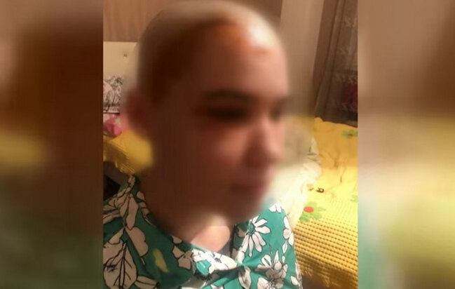 Bakıda gənc qızın başına binadan daş düşdü - VİDEO