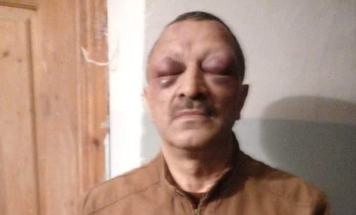 DİN Tofiq Yaqublunun döyülməsi faktını araşdıracaq - FOTO