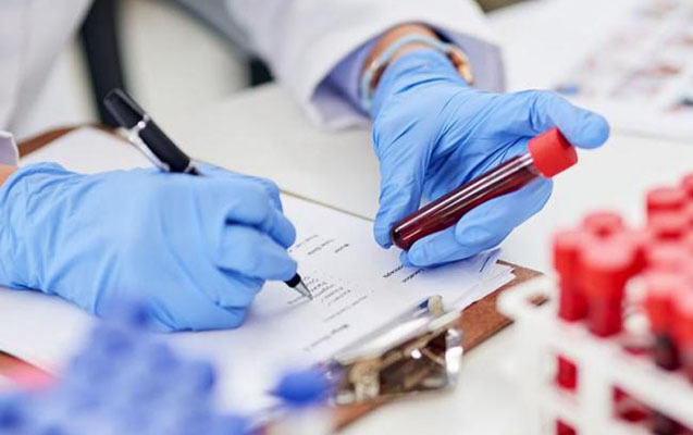 Yoluxanların sayı 500-ə düşdü