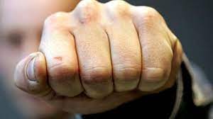 51 yaşlı kişi hücuma məruz qalıb