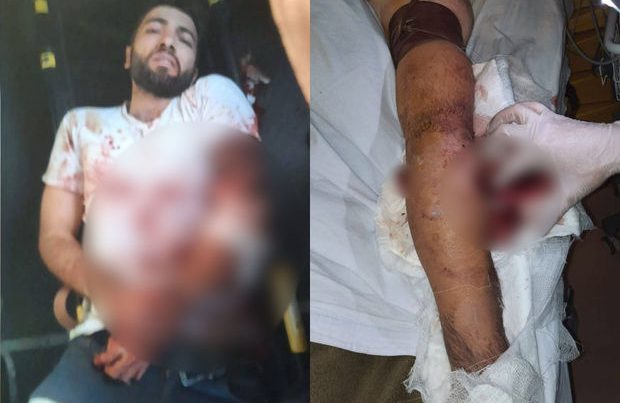 Ermənilərin açdığı atəş nəticəsində “Azercell”in əməkdaşı yaralanıb – FOTO