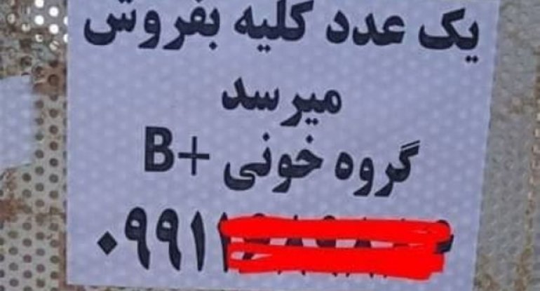 İranda çarəsiz insanlar böyrəklərini satır - FOTO