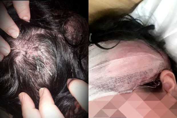 Bakıda DƏHŞƏT: Qadın qayınanası və həbsdən çıxmış əri tərəfindən amansızcasına döyüldü - FOTO