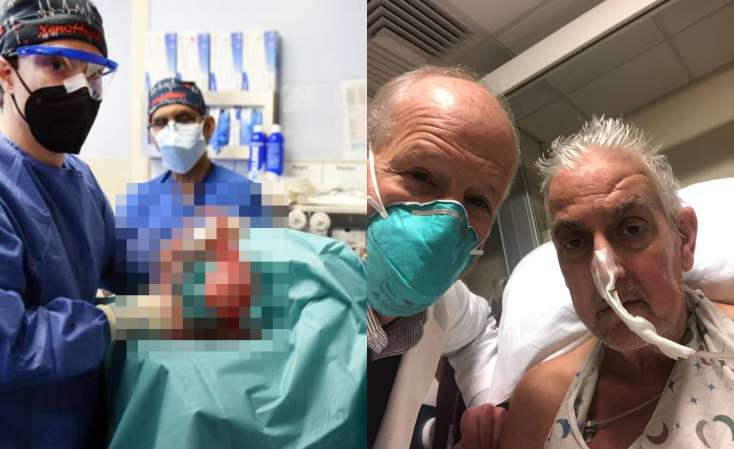 Dünya tibb tarixində İLK YAŞANDI: Donuz ürəyi insana köçürüldü - FOTO