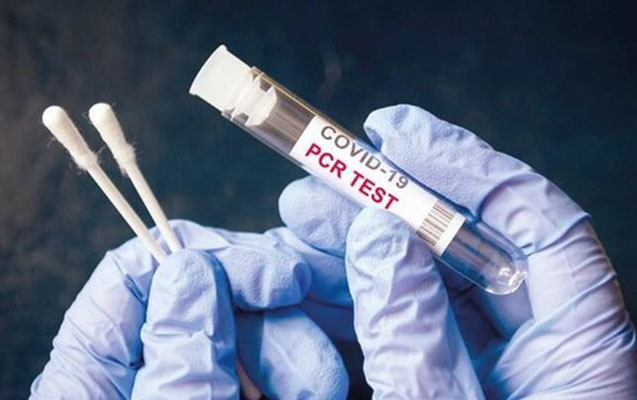 Türkiyədə PCR testi ilə bağlı qayda dəyişdi