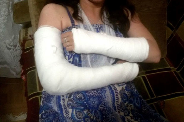 В Баку мужчина сломал руки своей невесте